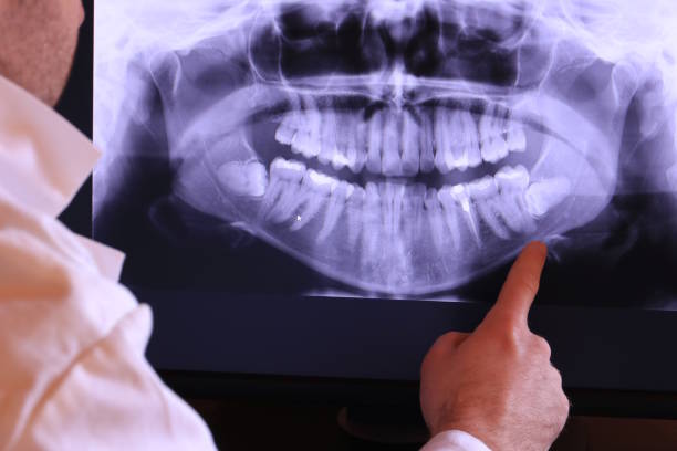 Best Broken or Chipped Tooth Repair in Belmont, MS